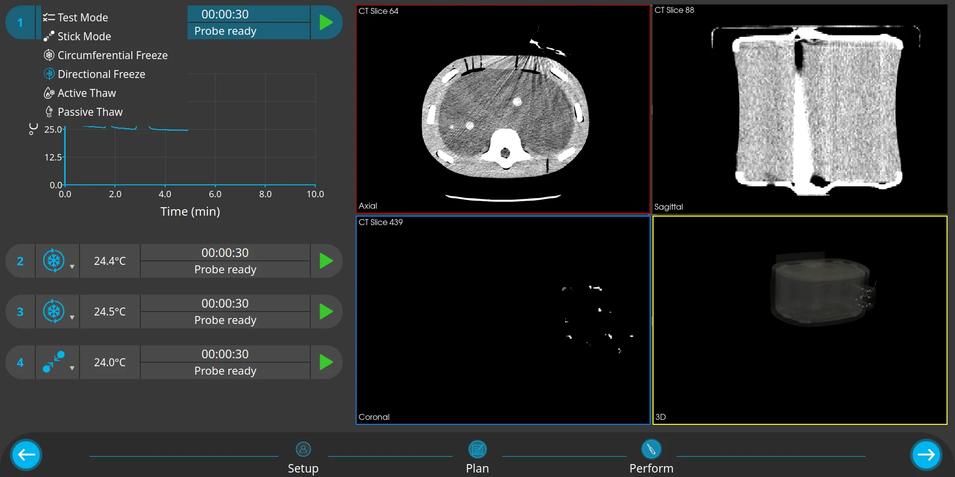 Focused Cryotherapy System software, Perform screen with four probes connected: channel 1 shows the mode menu and temperature history, channels 2 to 4 show probe ready, with axial, sagittal, coronal and 3D CT views on the right